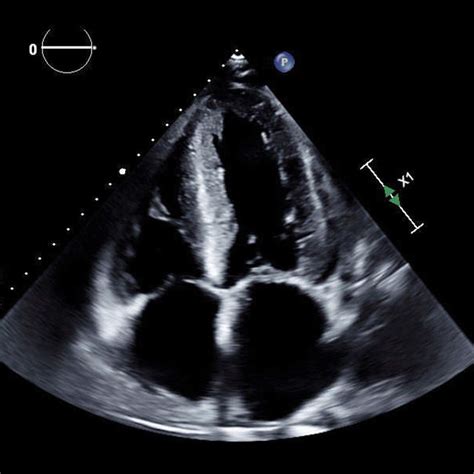 apical 4c.